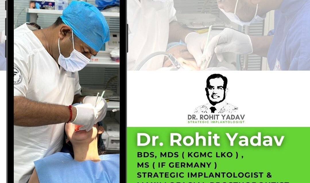 What Makes Dr. Rohit Yadav The Best Dental Implantologist In India?