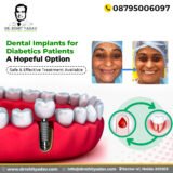 Best Dental Implants Advanced Implant