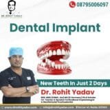 Top dental implant specialist India