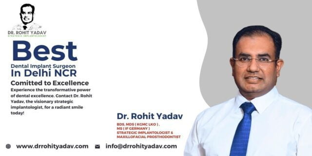 Expert Corticobasal Implantologist - Dr. Rohit Yadav