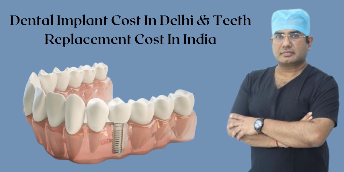 Dental Implant Cost In Delhi & Teeth Replacement Cost In India