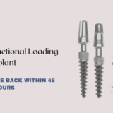 Immediate Functional Loading Implant