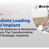 Immediate loading implants by Dr. Rohit Yadav