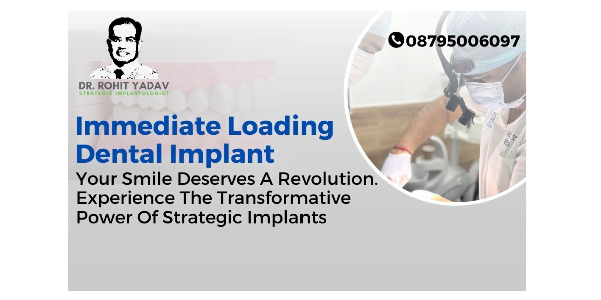 What is Immediate Functional Loading Implantology?